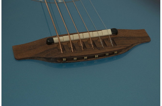 Ovation Pro Series Ultra 1516DTD-G Mid Non-Cutaway